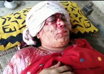 راڌڻ ۾ عورت تي مڙس جو بدترين تشدد، ڏنڊا هڻي مرڻينگ ڪري ڇڏيو