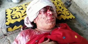 راڌڻ ۾ عورت تي مڙس جو بدترين تشدد، ڏنڊا هڻي مرڻينگ ڪري ڇڏيو