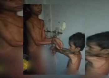 Karachi police rescue four children tortured, kept in chains by stepmother